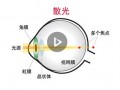 怎么知道眼睛散光，怎么知道眼睛散光不散光