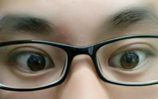 带眼镜变形怎么恢复，带眼镜变形怎么恢复原样